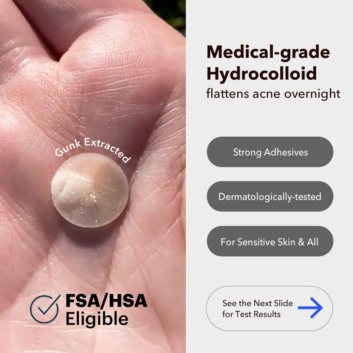 AVARELLE close-up of hydrocolloid patch texture highlighting thin profile