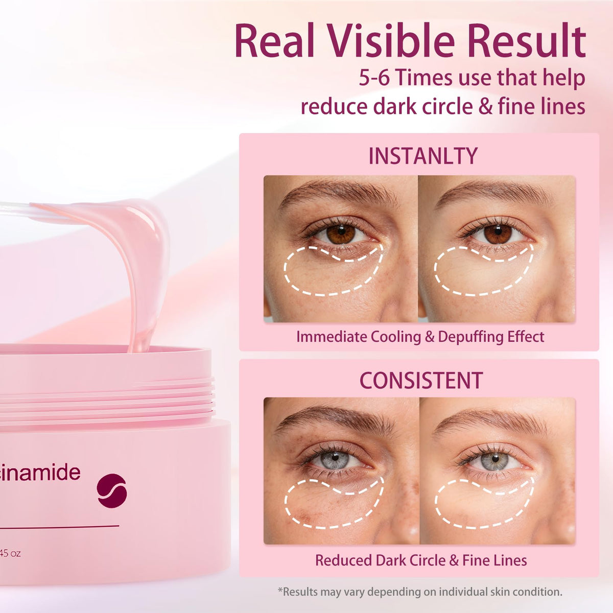AveCera patch applied under eye illustrating quick de-puffing effect