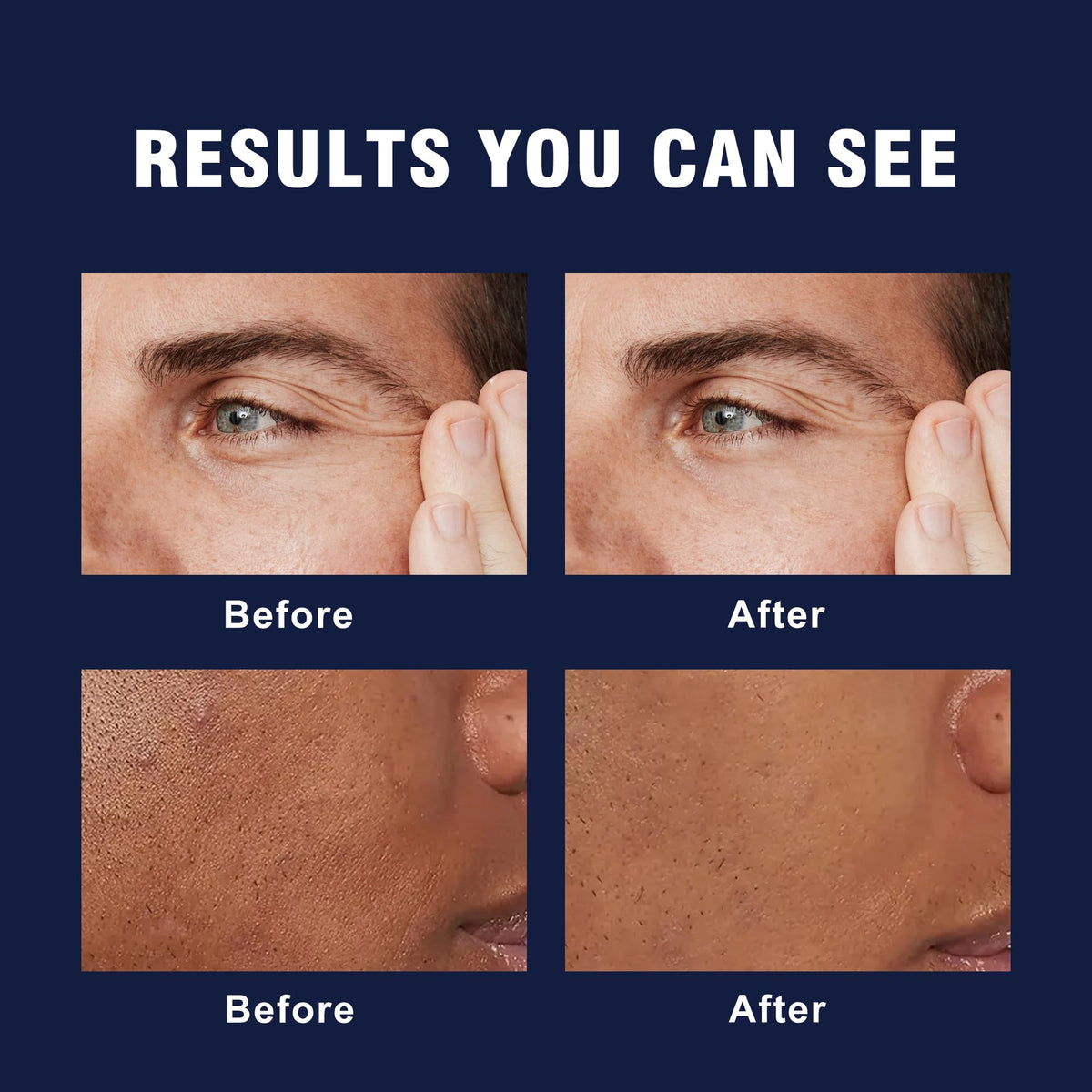 AVITAPURE caffeine and retinol visual emphasizing refreshed, firmer-looking skin