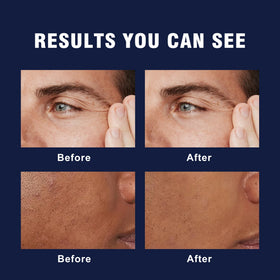 AVITAPURE caffeine and retinol visual emphasizing refreshed, firmer-looking skin
