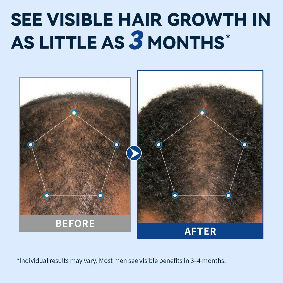 AVITAPURE spray texture close-up demonstrating fast-drying, non-greasy finish