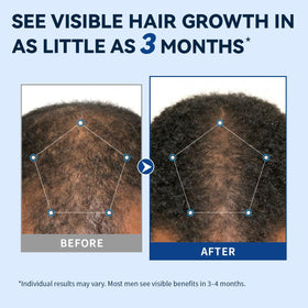 AVITAPURE spray texture close-up demonstrating fast-drying, non-greasy finish
