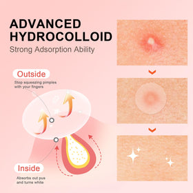 AVJONE close-up single pimple patch highlighting thin, invisible wear