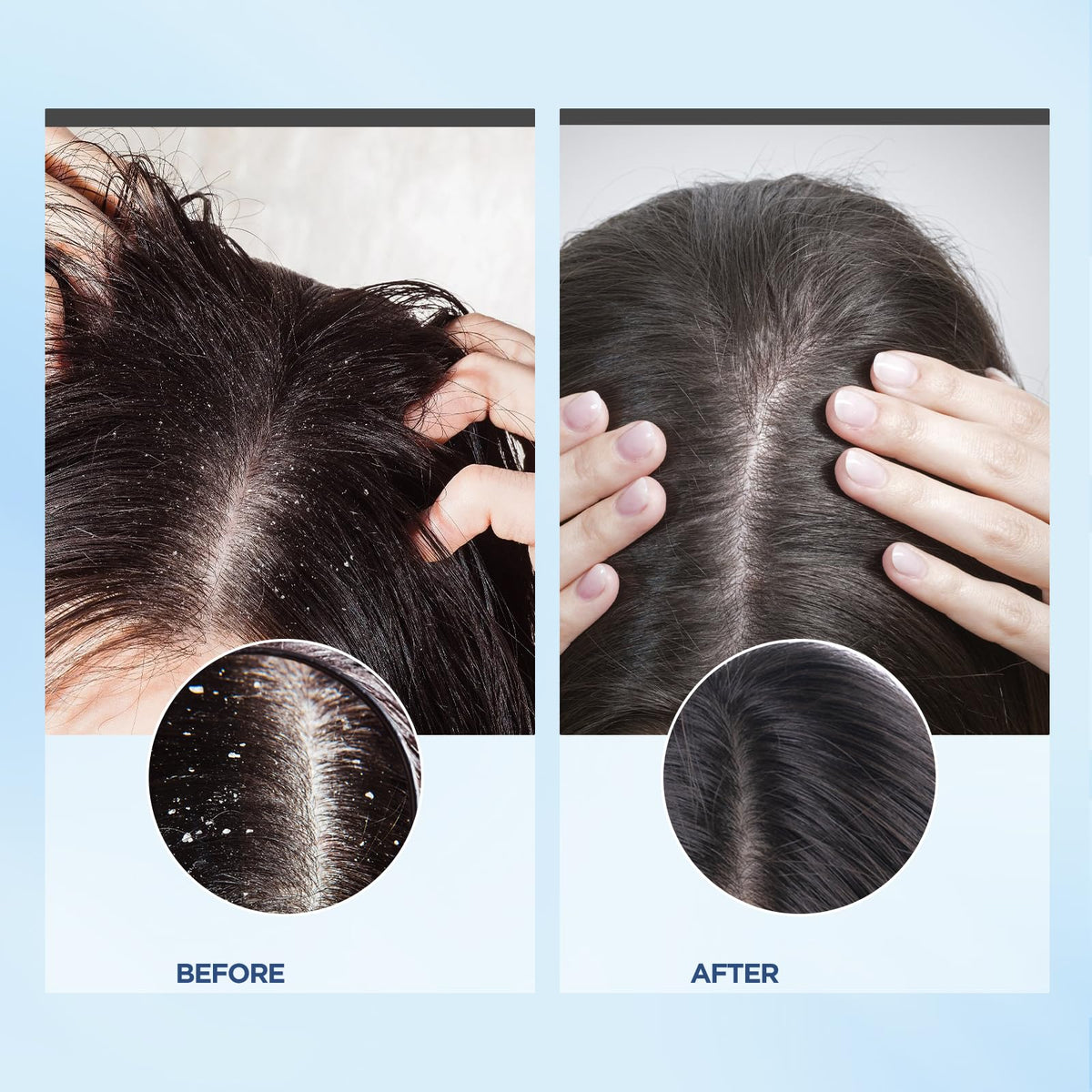 Bablabear being applied to wet scalp in hand to remove buildup