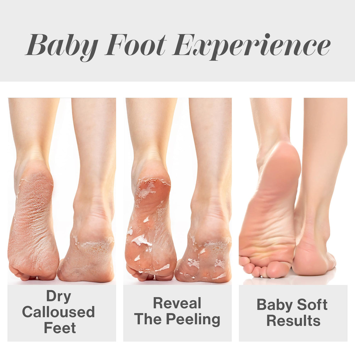 Baby Foot feet inside booties during treatment showcasing easy at-home use