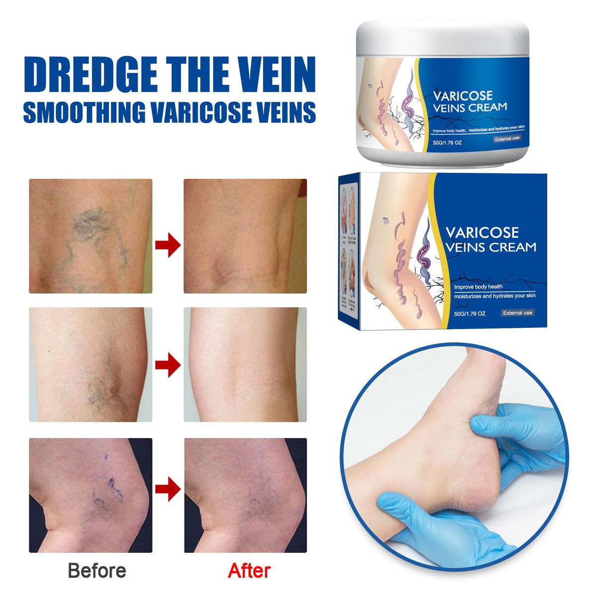 Balekotty being applied to lower leg showing smooth absorption benefit