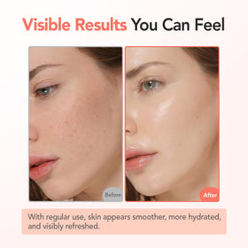 BALOOM application on hand demonstrating smooth glide and quick absorption benefit