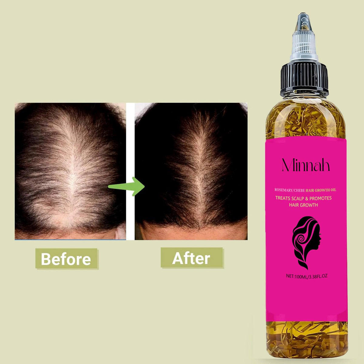 BALPPRD Minnah Batana scalp massage in use showing even distribution benefit
