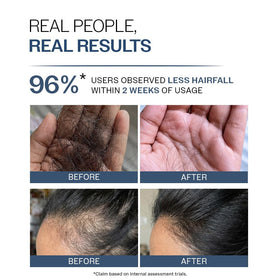 Bare Anatomy pH 4.6 label emphasizing scalp-friendly acidity