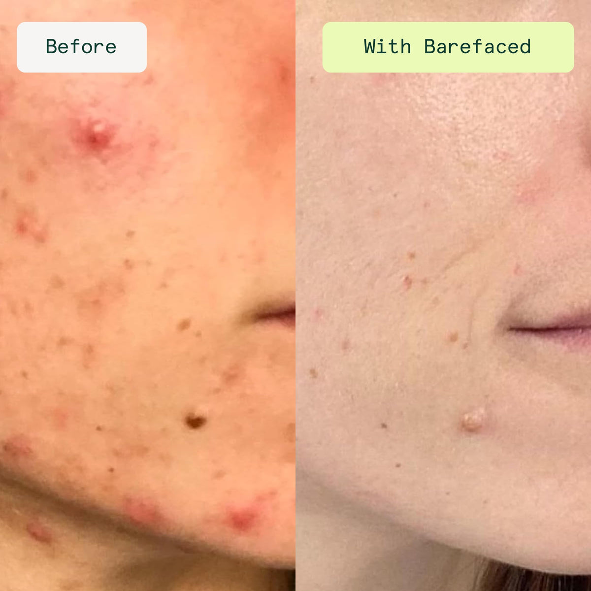Barefaced close-up of pad texture showing soft exfoliating surface for gentle resurfacing