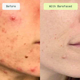 Barefaced close-up of pad texture showing soft exfoliating surface for gentle resurfacing