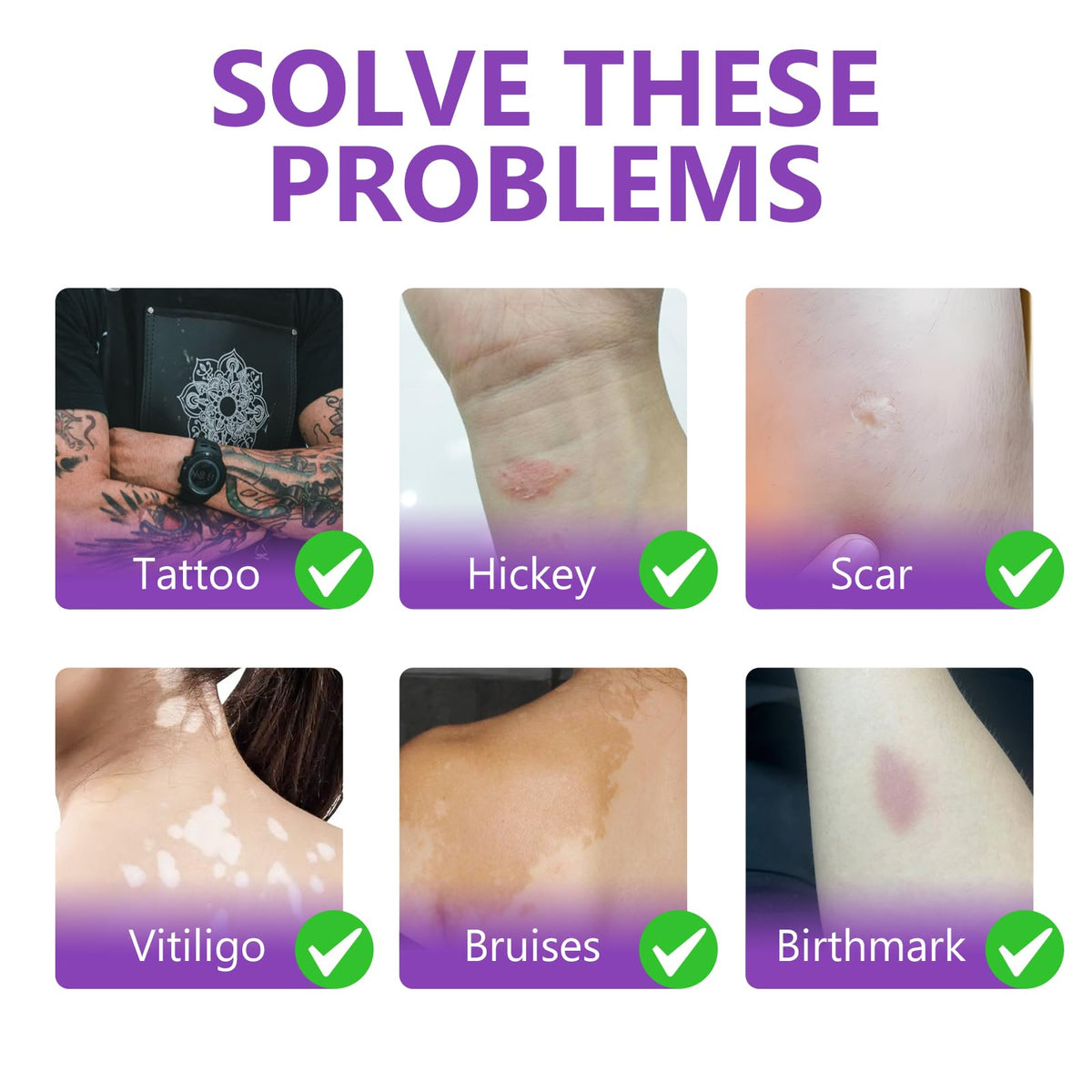barklytic before and after on arm demonstrating tattoo concealment benefit
