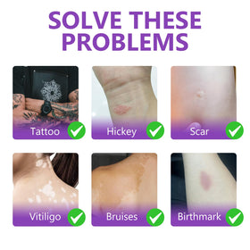 barklytic before and after on arm demonstrating tattoo concealment benefit