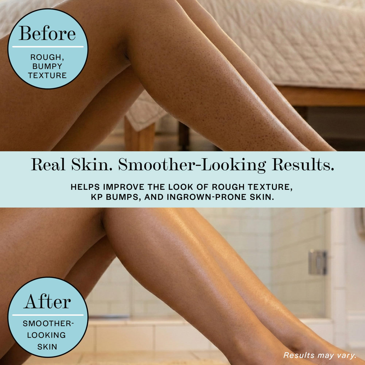 Base Laboratories being massaged onto leg to reduce strawberry skin