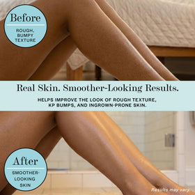Base Laboratories being massaged onto leg to reduce strawberry skin