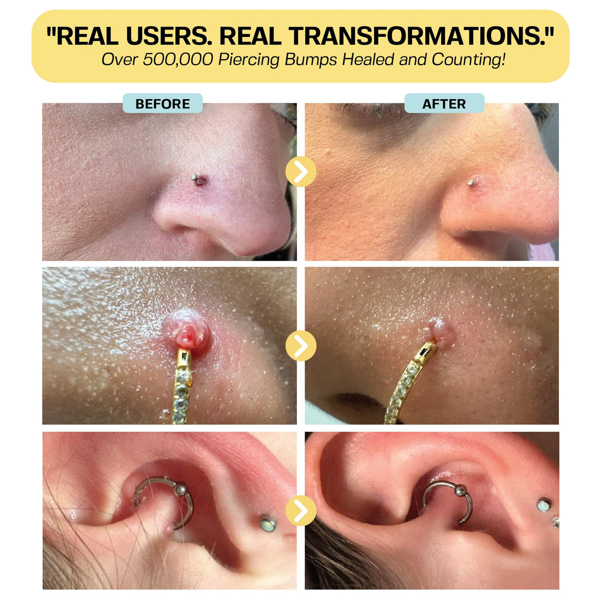 BASE LABORATORIES being applied to a nostril piercing to soothe and reduce bump appearance