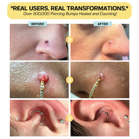 BASE LABORATORIES being applied to a nostril piercing to soothe and reduce bump appearance