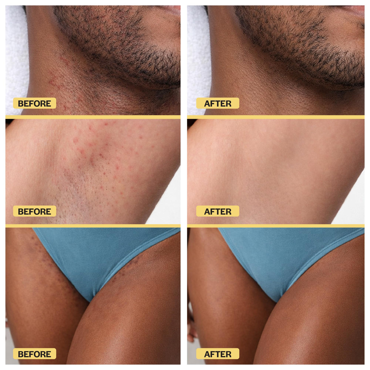 BASE LABORATORIES applied to beard area to soften coarse regrowth