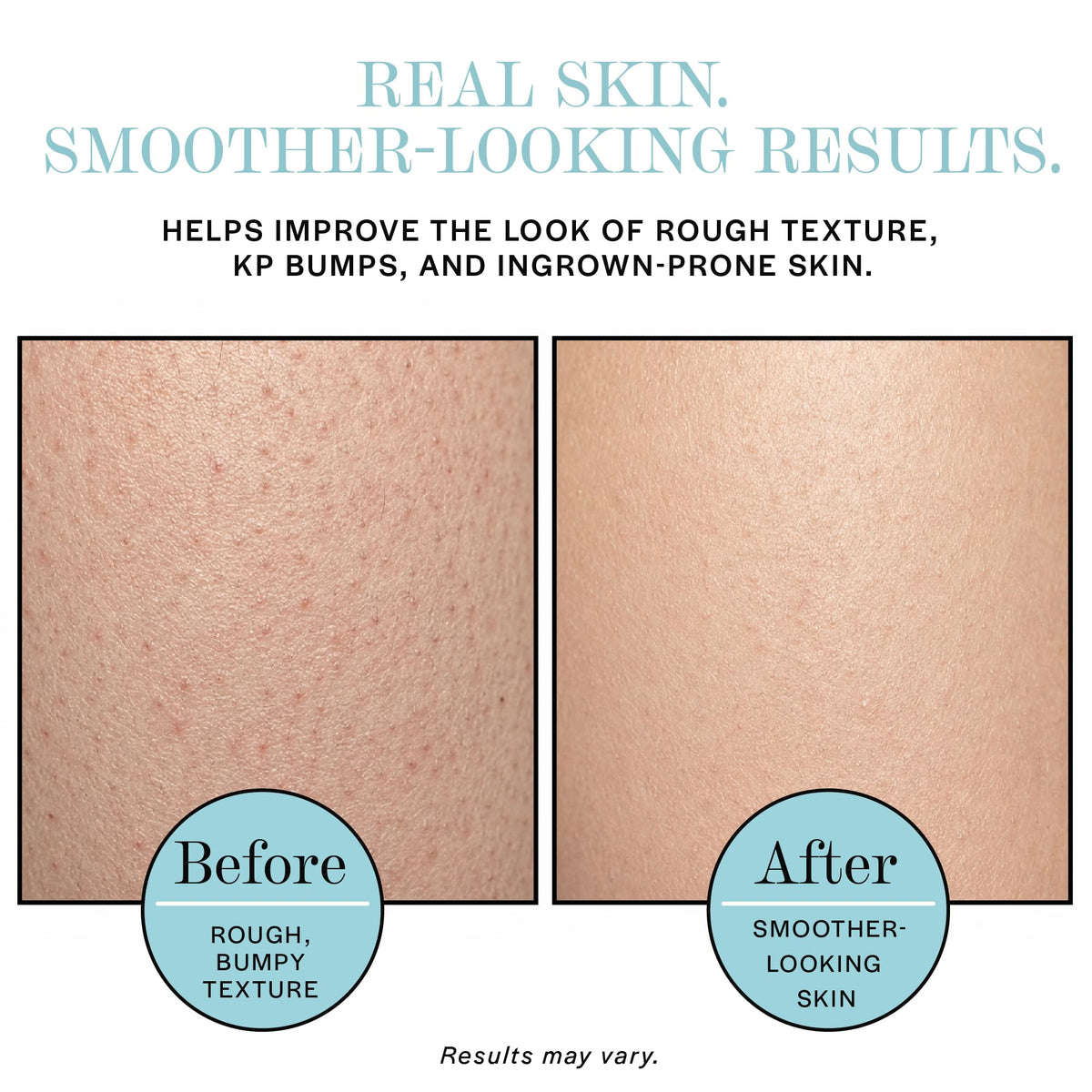 Base Laboratories product label highlighting AHA BHA ingredients and benefits