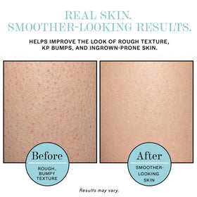 Base Laboratories product label highlighting AHA BHA ingredients and benefits