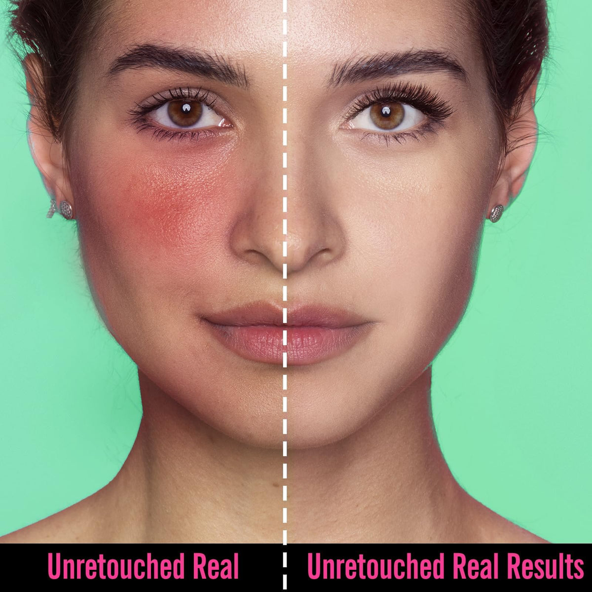 bayfree application on hand demonstrating coverage and redness reduction benefit