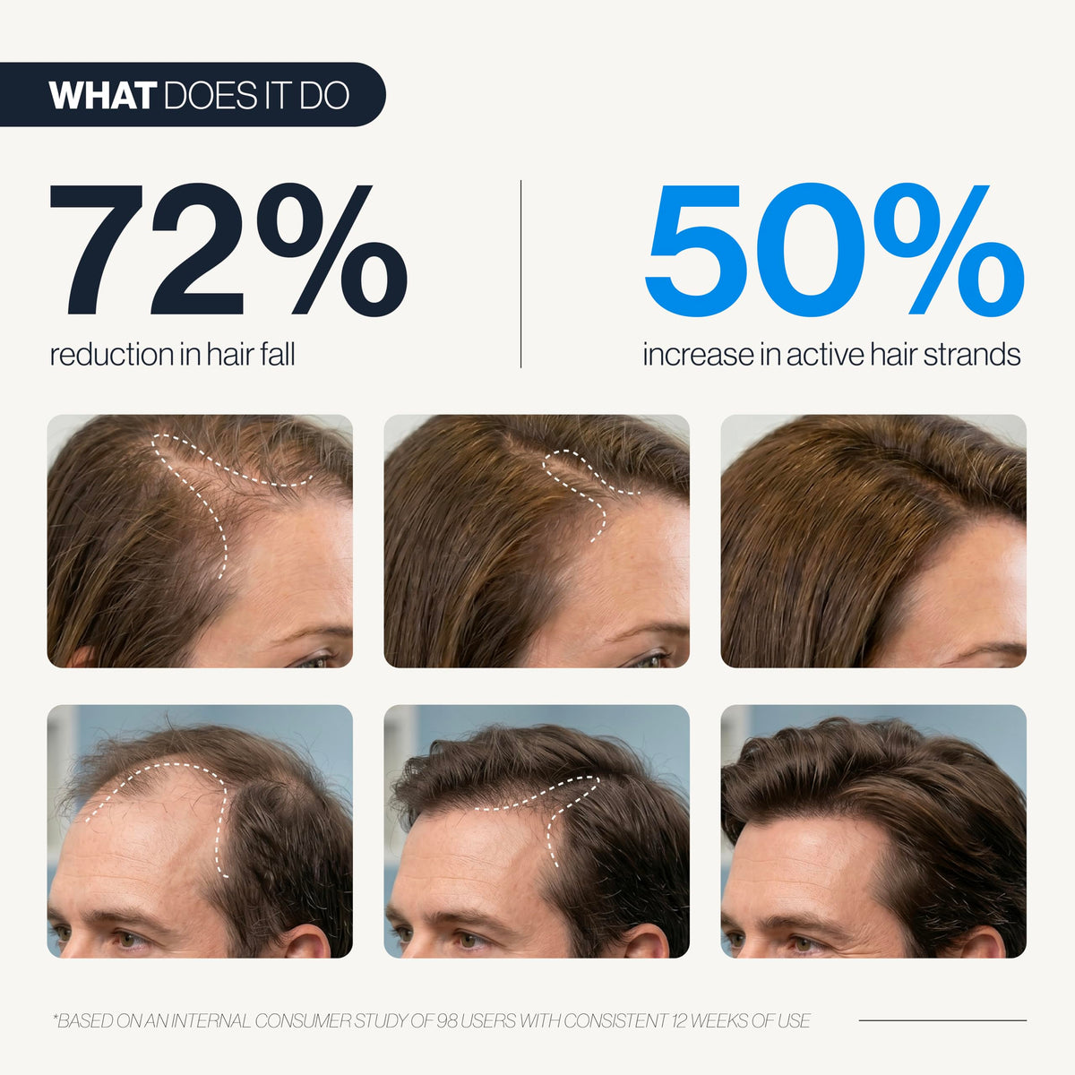 Be Bodywise applied to thinning area, illustrating targeted delivery and focused benefit
