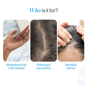 Be Bodywise roller tip close-up demonstrating precise scalp application benefit