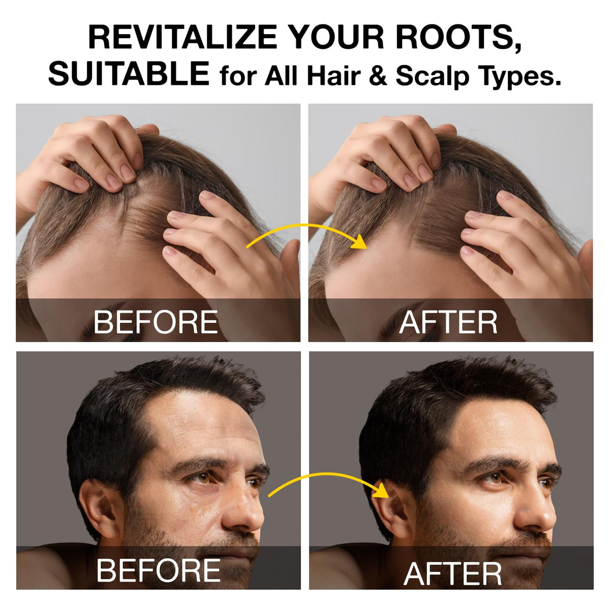 Beadlamey applied to scalp during massage to stimulate follicles and circulation