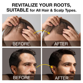 Beadlamey applied to scalp during massage to stimulate follicles and circulation