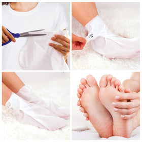 BEALUZ peeled skin results after treatment revealing softer foot skin