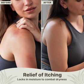 Beauty by Earth applying gel to skin for instant cooling relief