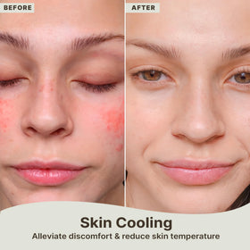 Beauty by Earth aloe gel in after-sun routine calming sun-exposed skin