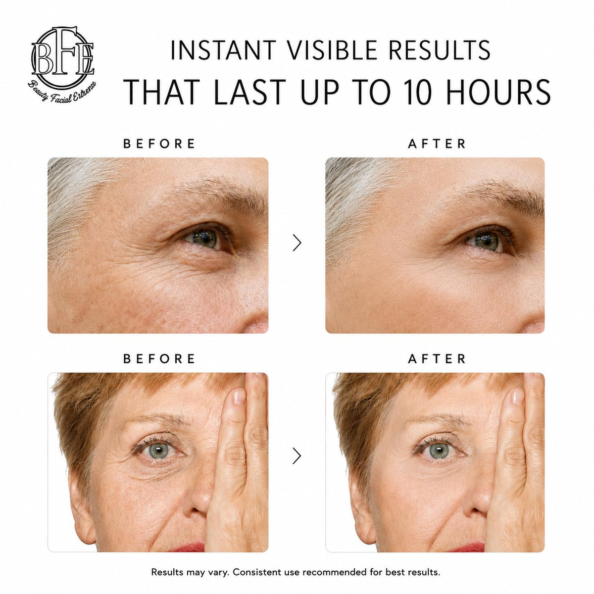 Beauty Facial Extreme before and after under-eye smoothing visible result