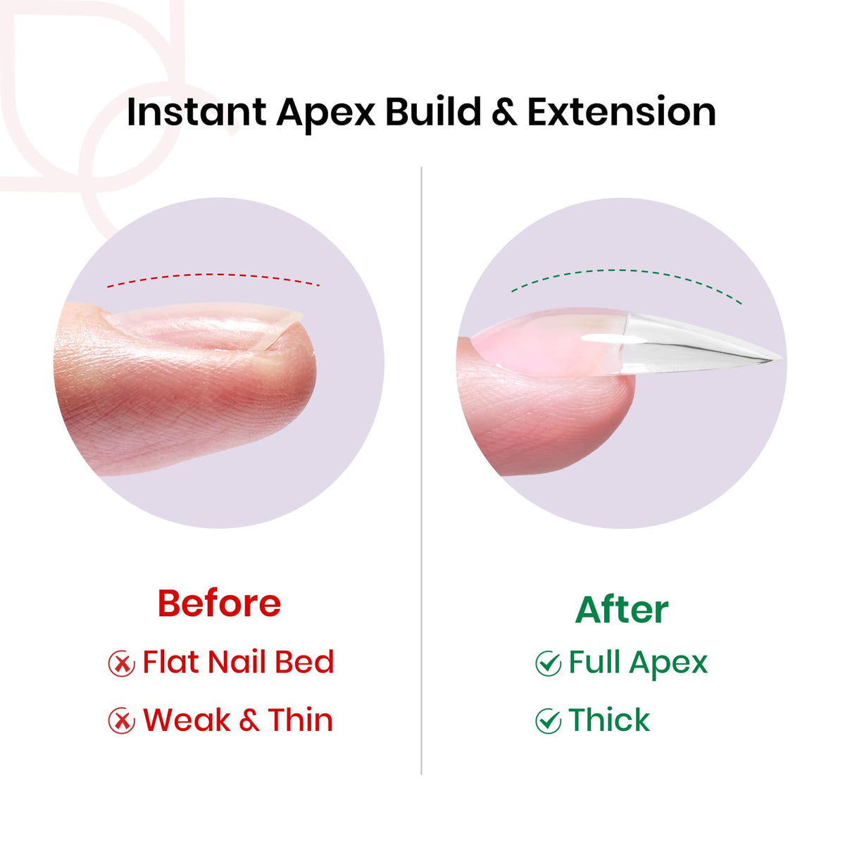 beetles Tipex apex close-up highlighting thick arch for durable salon-like results