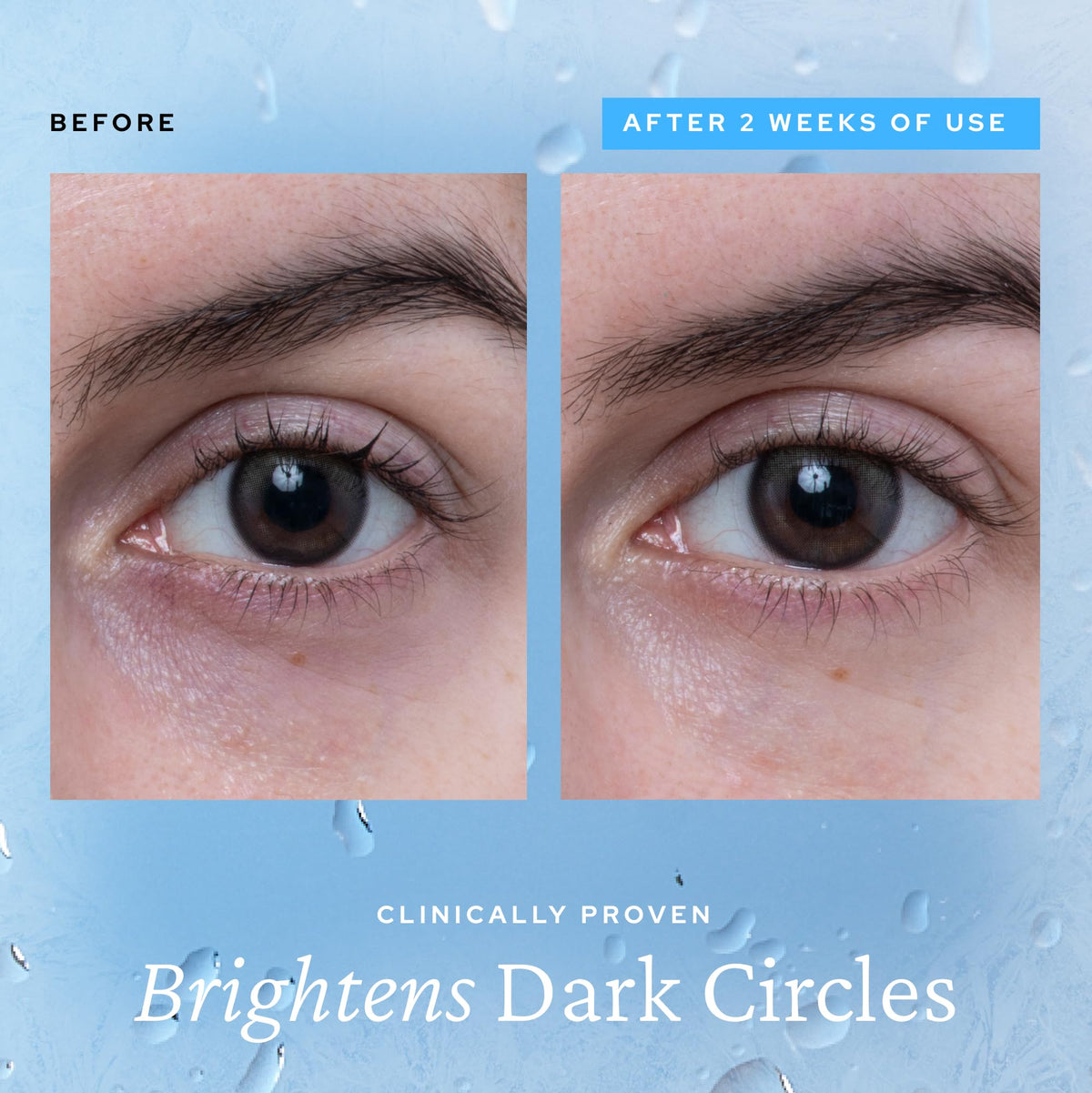 belif gel texture on skin demonstrating lightweight hydration and fast absorption