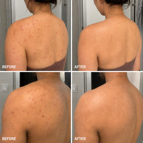 BellamiLuxx used on back in shower highlighting targeted cleansing