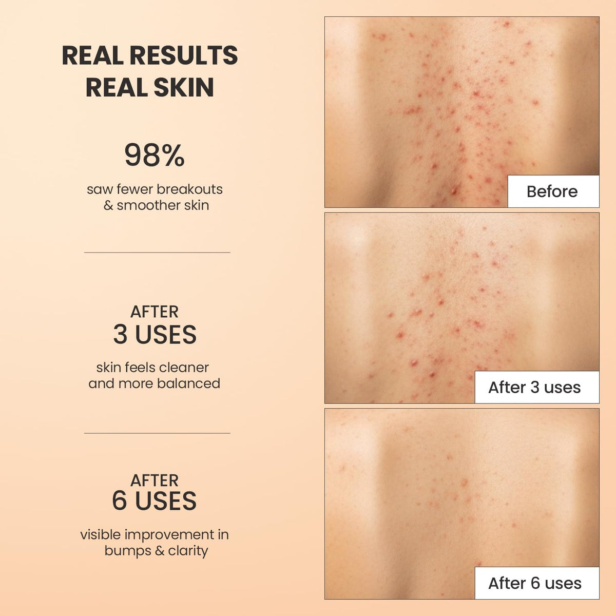 BellamiLuxx being used in shower on back demonstrating clearer-texture benefit