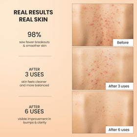 BellamiLuxx being used in shower on back demonstrating clearer-texture benefit