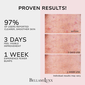 BellamiLuxx cream texture close-up highlighting lightweight non-greasy absorption benefit