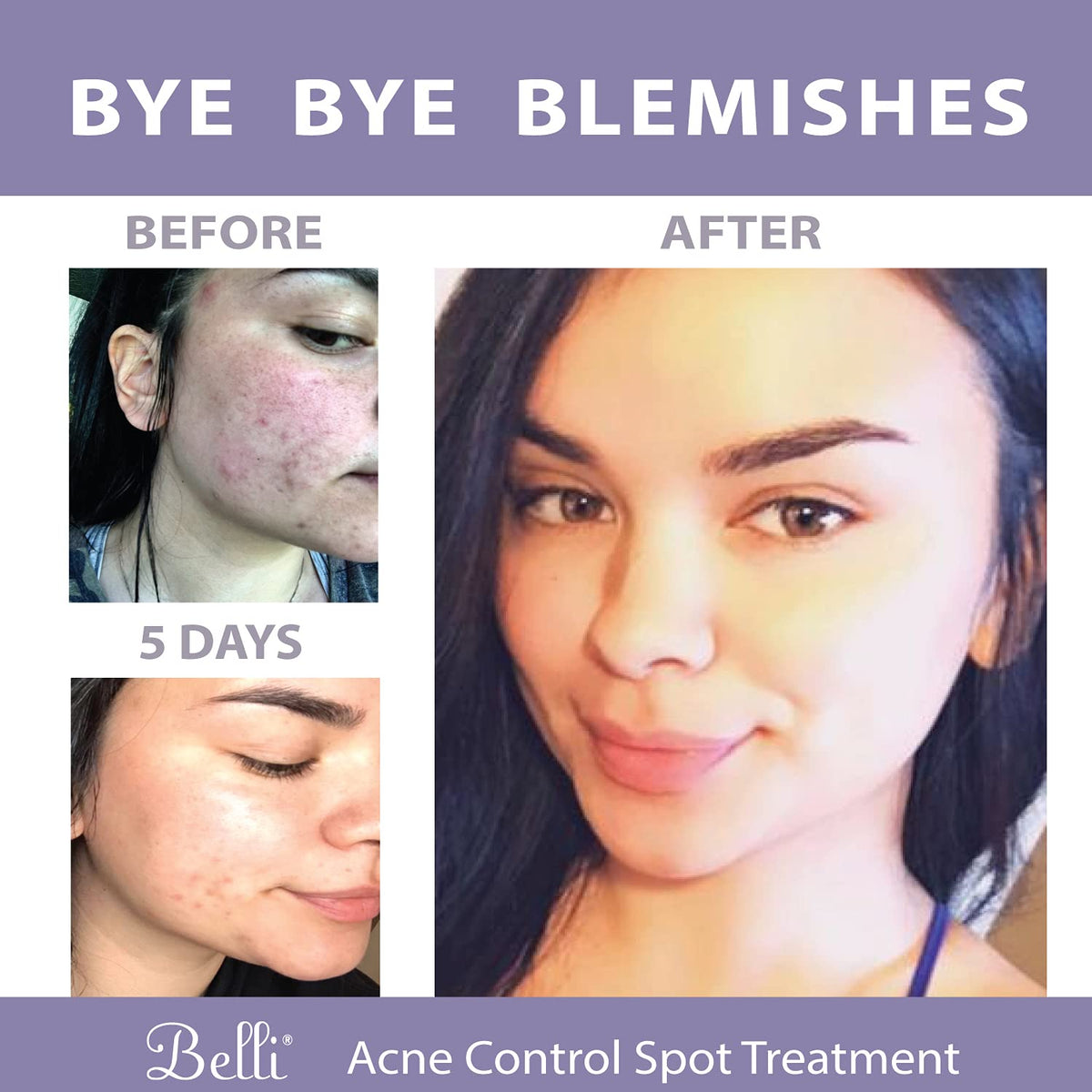 Belli spot treatment applied during skincare routine demonstrating targeted overnight use
