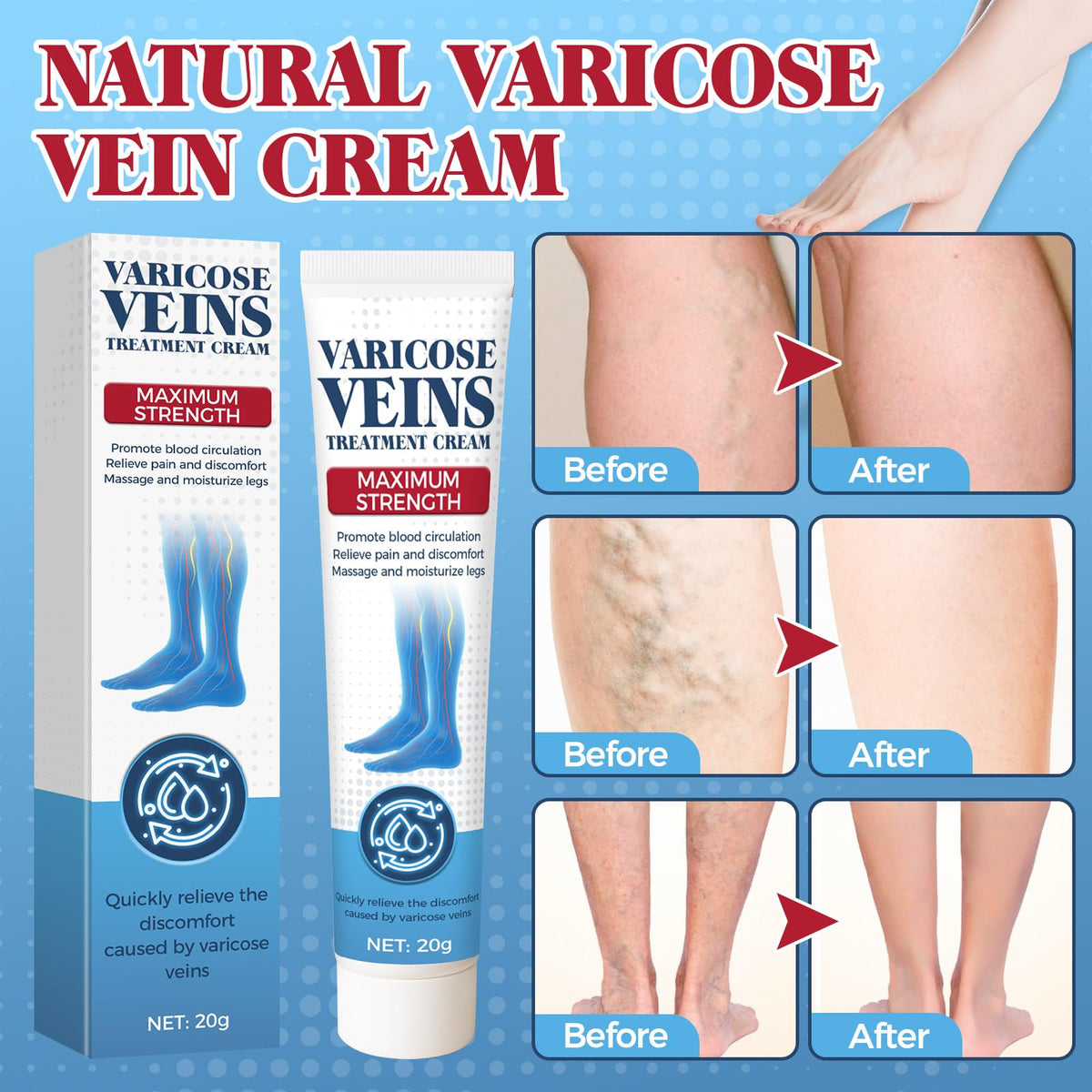 Bellisinno leg massage showing upward stroke to support circulation