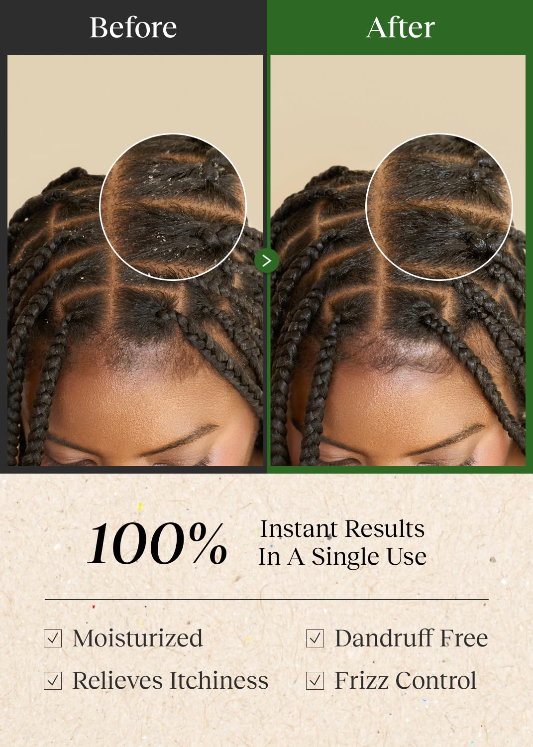 Bephor scalp before and after wipe showing reduced buildup and fresher scalp
