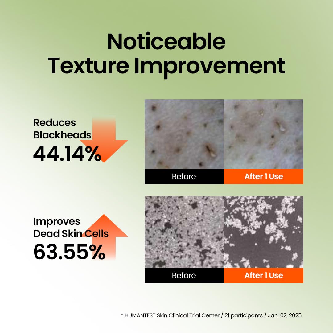 beplain softener texture on skin close-up showing gentle consistency