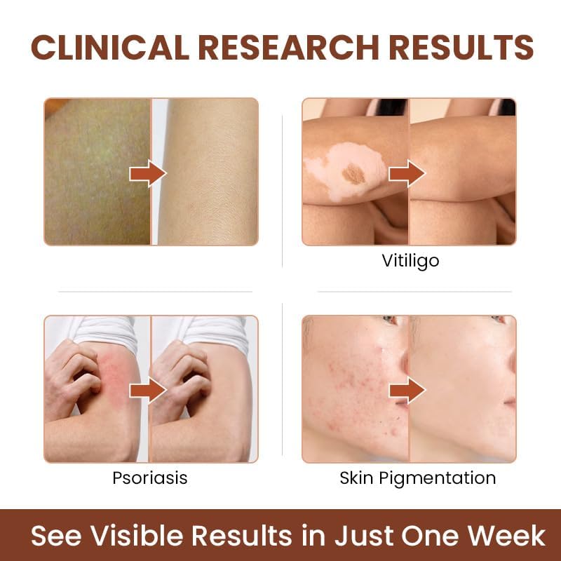 BERVEAL application demonstration on hand showing targeted spot treatment benefit