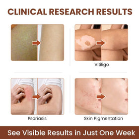 BERVEAL application demonstration on hand showing targeted spot treatment benefit