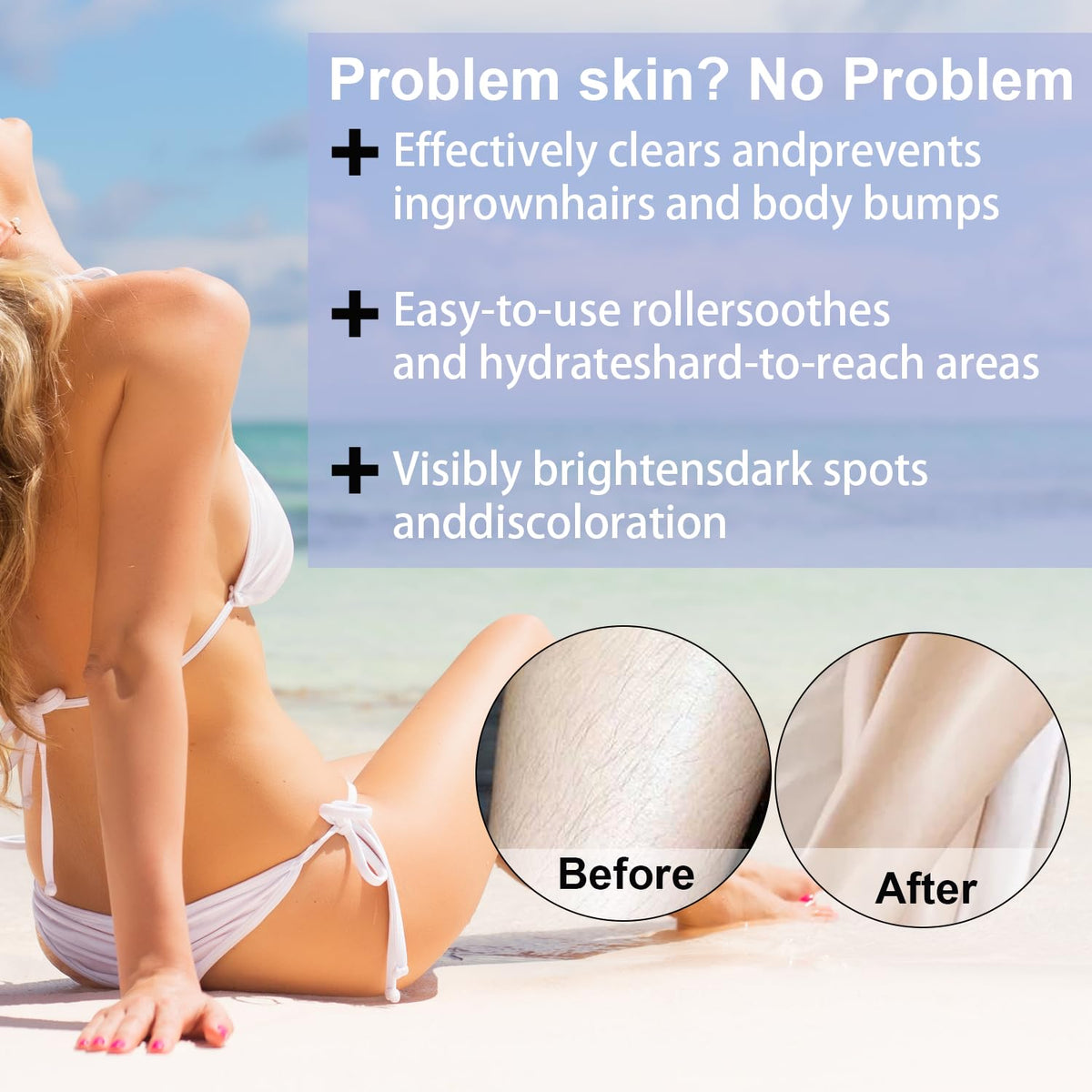 BETTENKO applying serum to bikini line to soothe irritation and reduce bumps