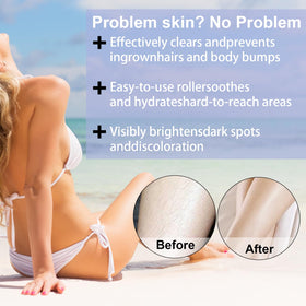 BETTENKO applying serum to bikini line to soothe irritation and reduce bumps