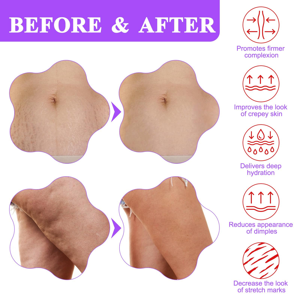 BETTENKO neck lift demonstration highlighting visible tightening benefit