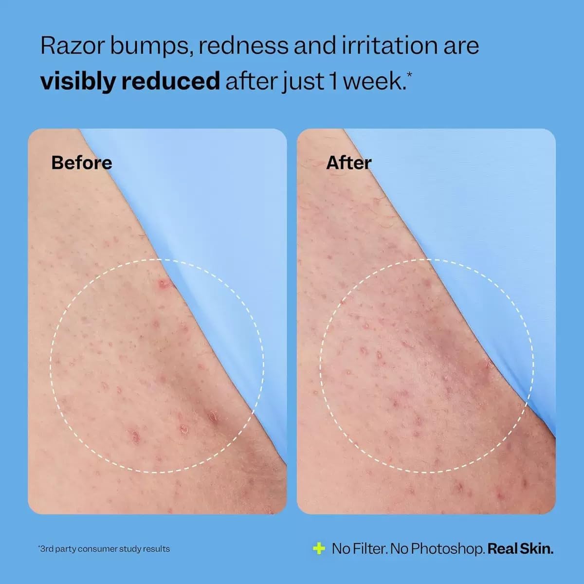 BETTENKO clear drop of serum on hand showing lightweight fast-absorbing texture