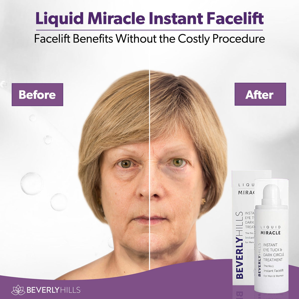 Beverly Hills applying serum under eye to reduce puffiness and smooth skin